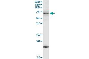 TNK2 MaxPab rabbit polyclonal antibody. (TNK2 antibody  (AA 1-352))
