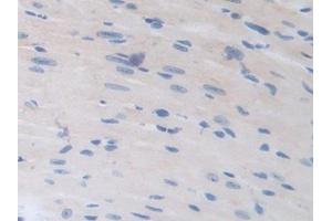 Detection of HPSE in Mouse Heart Tissue using Polyclonal Antibody to Heparanase (HPSE)