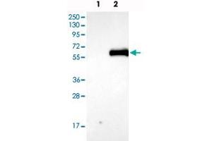 Western blot analysis of Lane 1: Negative control (vector only transfected HEK293T lysate), Lane 2: Over-expression Lysate (Co-expressed with a C-terminal myc-DDK tag (~3. (AGT antibody)