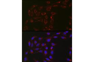 Immunofluorescence analysis of U2OS cells using  Rabbit mAb (ABIN7265367) at dilution of 1:100 (40x lens). (ACAA2 antibody)