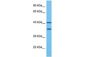 Western Blotting (WB) image for anti-Paired Box Gene 2a (PAX2A) (Middle Region) antibody (ABIN2792620)