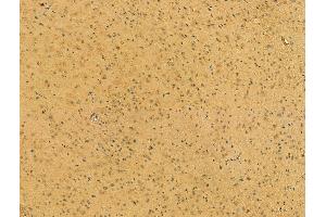 ABIN6265289 and ABIN6273076 at 1/100 staining Mouse brain tissue by IHC-P.