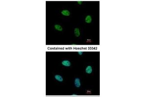 ICC/IF Image Immunofluorescence analysis of paraformaldehyde-fixed HeLa, using NUR77, antibody at 1:500 dilution. (NR4A1 antibody  (C-Term))
