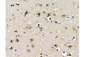 ABIN7096729 and ABIN7100794 at 1/100 staining mouse brain tissue by IHC-P.