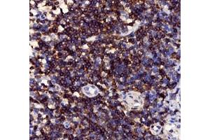 Immunohistochemistry of paraffin embedded human tonsil using CD3 (ABIN7073386) at dilution of 1: 1000 (400x lens) (CD3 antibody)