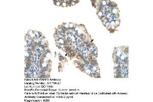 Human Intestine (PARP6 antibody  (C-Term))
