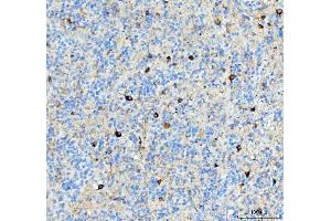 IHC analysis of Alpha Internexin using anti-Alpha Internexin antibody (ABIN4886634). (INA antibody  (AA 71-161))