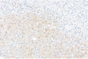 Immunohistochemistry (IHC) image for anti-Nicotinamide phosphoribosyltransferase (NAMPT) (AA 400-450) antibody (ABIN7454619) (NAMPT antibody  (AA 400-450))