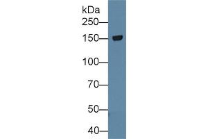 Western Blot; Sample: Rat Cerebrum lysate; Primary Ab: 1µg/ml Rabbit Anti-Rat TNR Antibody Second Ab: 0. (Tenascin R antibody  (AA 329-588))