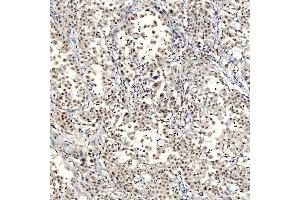 IHC analysis of SNRNP40 using anti-SNRNP40 antibody (ABIN7601719).