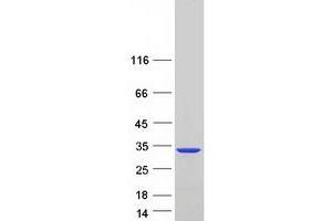Western Blotting (WB) image for Platelet-Activating Factor Acetylhydrolase 1b, Catalytic Subunit 3 (29kDa) (PAFAH1B3) (Transcript Variant 1) protein (Myc-DYKDDDDK Tag) (ABIN2728149)