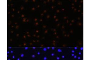 Immunofluorescence analysis of C6 cells using NPAS2 Polyclonal Antibody at dilution of 1:100 (40x lens).
