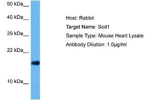 Host: Mouse Target Name: SOD1 Sample Tissue: Mouse Heart Antibody Dilution: 1ug/ml (SOD1 antibody  (C-Term))