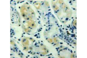 Used in DAB staining on fromalin fixed paraffin-embedded Stomach tissue (GRO gamma antibody  (AA 35-107))