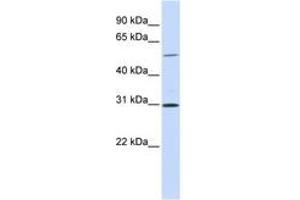 Image no. 1 for anti-NIMA related kinase 3 (NEK3) (AA 108-157) antibody (ABIN6741054) (NEK3 antibody  (AA 108-157))