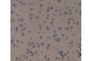 #VALUE! (SAG antibody  (AA 4-249))