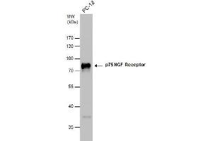 WB Image p75 NGF Receptor antibody detects p75 NGF Receptor protein by western blot analysis.