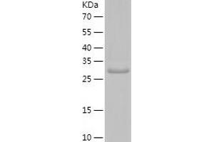 Western Blotting (WB) image for Plasminogen (PLG) (AA 98-356) protein (His tag) (ABIN7124464) (PLG Protein (AA 98-356) (His tag))