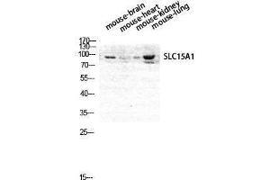 Western Blotting (WB) image for anti-Solute Carrier Family 15 (Oligopeptide Transporter), Member 1 (SLC15A1) (Internal Region) antibody (ABIN3176831) (SLC15A1 antibody  (Internal Region))