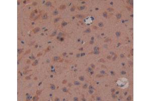 IHC-P analysis of brain tissue, with DAB staining.