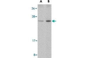 Western blot analysis of DDIT4 in human kidney tissue lysate with DDIT4 polyclonal antibody  at (A) 0.