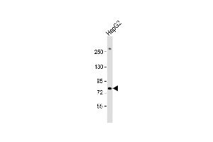 Anti-PIGR Antibody (C-term) at 1:1000 dilution + HepG2 whole cell lysate Lysates/proteins at 20 μg per lane.