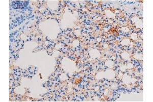 Immunohistochemistry (IHC) image for anti-Insulin Receptor Substrate 1 (IRS1) (pSer639) antibody (ABIN6256390)