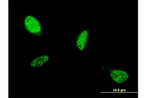 Immunofluorescence of monoclonal antibody to ATOH1 on HeLa cell. (ATOH1 antibody  (AA 266-354))