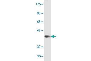 Western Blot detection against Immunogen (36. (JMJD1C antibody  (AA 2-99))