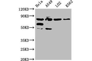 Western Blot Positive WB detected in: Hela whole cell lysate, A549 whole cell lysate, L02 whole cell lysate, K562 whole cell lysate All lanes: MTRR antibody at 1:2000 Secondary Goat polyclonal to rabbit IgG at 1/50000 dilution Predicted band size: 81, 78, 7 kDa Observed band size: 81 kDa