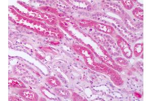 Human Kidney: Formalin-Fixed Paraffin-Embedded (FFPE) (SMO antibody  (N-Term))
