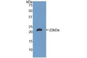 Detection of Recombinant LAMa1, Mouse using Polyclonal Antibody to Laminin Alpha 1 (LAMA1) (Laminin alpha 1 antibody  (AA 2640-2773))