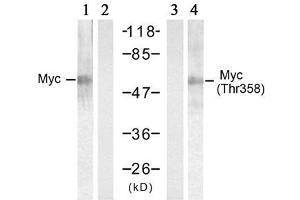 Western blot analysis of extracts from HT-29 cells treated with UV (20min), using Myc (Ab-358) antibody (E021035, Lane 1 and 2) and Myc (phospho-Thr358) antibody (E011035, Lane 3 and 4). (c-MYC antibody  (pThr358))