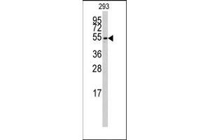 Image no. 1 for anti-Cytochrome P450, Family 26, Subfamily B, Polypeptide 1 (CYP26B1) (C-Term) antibody (ABIN360415)
