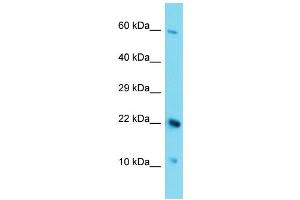 Host: Rabbit Target Name: C17orf105 Sample Type: HepG2 Whole Cell lysates Antibody Dilution: 1. (C17ORF105 antibody  (Middle Region))