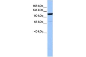 Western Blotting (WB) image for anti-Nucleoporin 155kDa (NUP155) antibody (ABIN2463582) (NUP155 antibody)