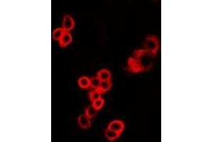 Immunofluorescent analysis of MALT1 staining in U2OS cells. (MALT1 antibody)