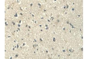 Immunohistochemistry (IHC) image for anti-Aldehyde Dehydrogenase 1 Family, Member A2 (ALDH1A2) (AA 1-422) antibody (ABIN7435901)