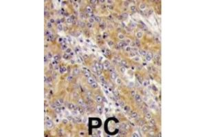 Immunohistochemistry (IHC) image for anti-Myosin ID (MYO1D) antibody (ABIN3002631) (Myosin ID antibody)
