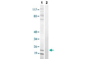Western blot analysis of Lane 1: nocodazole treated COS-7 cells, Lane 2: antigen-specific peptide treated COS-7 cells with STMN1 (phospho S63) polyclonal antibody  at 1:500-1:1000 dilution. (Stathmin 1 antibody  (pSer63))