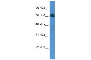 WB Suggested Anti-SMARCD3 Antibody Titration:  0. (SMARCD3 antibody  (N-Term))