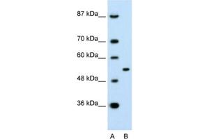 Western Blotting (WB) image for anti-Amyloid beta (A4) Precursor Protein-Binding, Family A, Member 1 (APBA1) antibody (ABIN2463761) (APBA1 antibody)