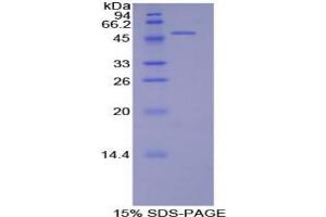 SDS-PAGE analysis of Rat PECAM1 Protein.