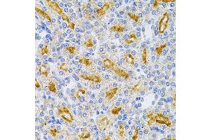 Immunohistochemistry of paraffin-embedded rat kidney using MyD88 Antibody (ABIN6128257, ABIN6144228, ABIN6144229 and ABIN6213986) at dilution of 1:100 (40x lens). (MYD88 antibody  (AA 60-309))