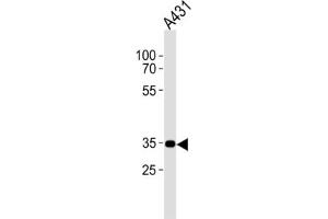 Western Blotting (WB) image for anti-Cannabinoid Receptor 2 (CNR2) antibody (ABIN2995770) (CNR2 antibody)