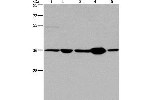 Western Blot analysis of Human transitional cell carcinoma tissue, 293T and A172 cell, Human testis tissue and Hela cell using LZTFL1 Polyclonal Antibody at dilution of 1:550 (LZTFL1 antibody)