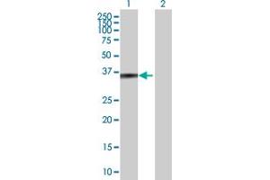 Western Blot analysis of ZADH1 expression in transfected 293T cell line by ZADH1 MaxPab polyclonal antibody. (PTGR2 antibody  (AA 1-351))