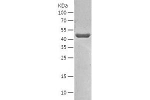 NAP1L1 Protein (AA 1-388) (His tag)