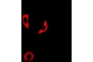 Immunofluorescent analysis of IL-18BP staining in A549 cells. (IL18BP antibody)