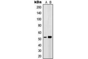 Western blot analysis of EP4 expression in Ramos (A), HeLa (B) whole cell lysates.